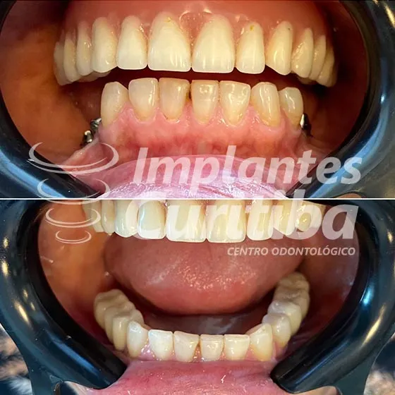 imagem de comparacao