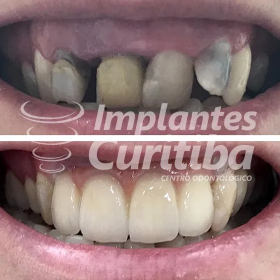 imagem de comparacao