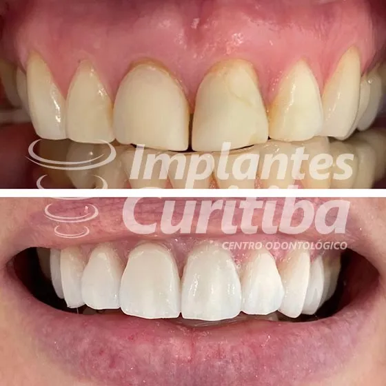 imagem de comparacao