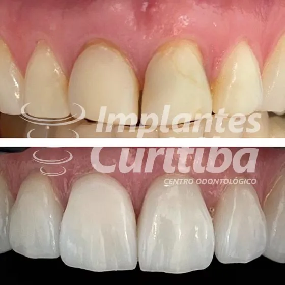 imagem de comparacao