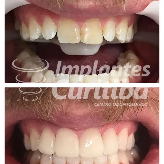 imagem de comparacao