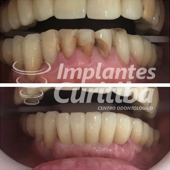 imagem de comparacao