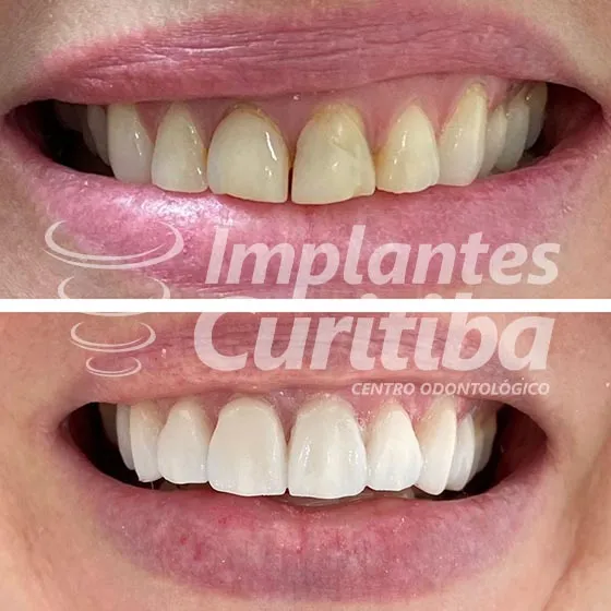 imagem de comparacao