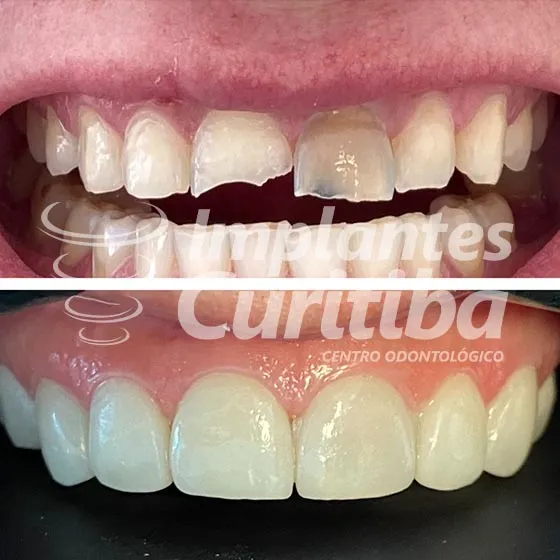 imagem de comparacao