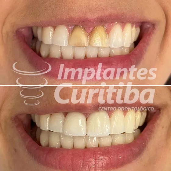 imagem de comparacao