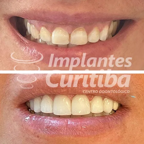 imagem de comparacao