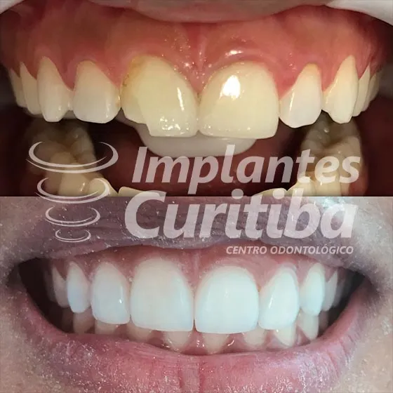 imagem de comparacao