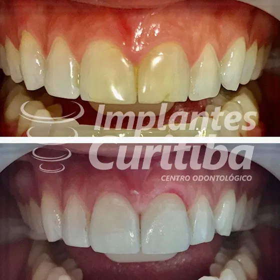 imagem de comparacao