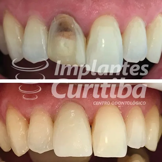 imagem de comparacao