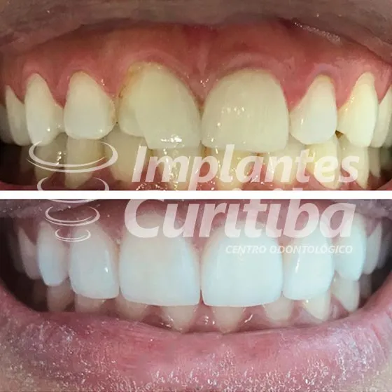 imagem de comparacao