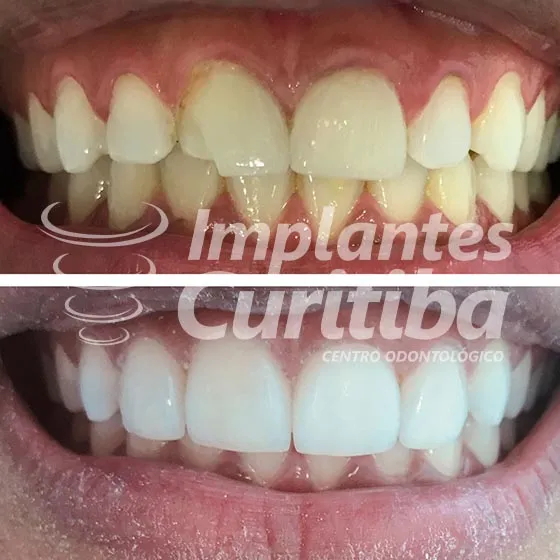 imagem de comparacao