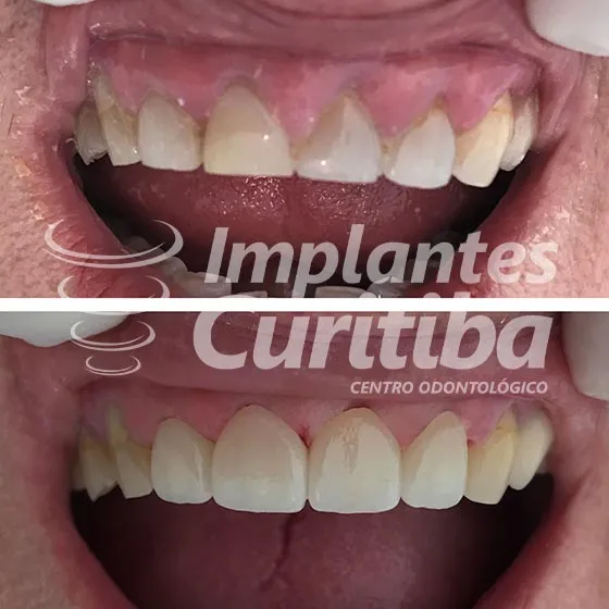 imagem de comparacao