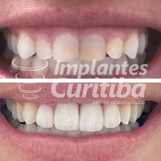 imagem de comparacao