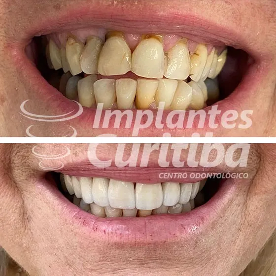 imagem de comparacao