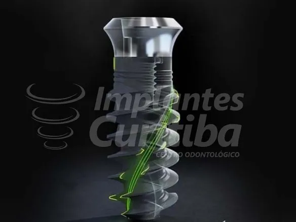 IMPLANTES IMPORTADOS<br> DE CICATRIZAÇÃO RÁPIDA