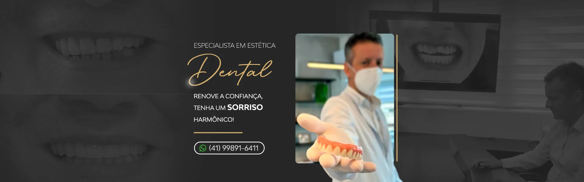 Implantes Curitiba | Imagem ilustrativa